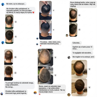 Dutly — Efekt Pełniejszych Włosów